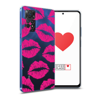 ����������� ����� ����-������� ������ ������� �� Xiaomi Redmi Note 11E Pro