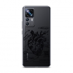 ����������� ����� ������������� ������ 2 �� Xiaomi 12T Pro