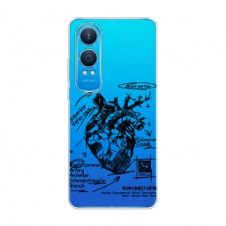 ����������� ����� ������������� ������ 2 �� OnePlus Nord CE4 Lite 5G