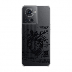 ����������� ����� ������������� ������ 2 �� OnePlus 10R