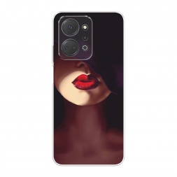����������� ����� ������� ���� �� Honor X7A