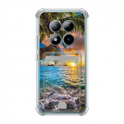  ������ 5 �� Redmi Note 15 Pro Plus 5G