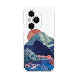  ����� � ������� ����� �� Honor 400 Pro
