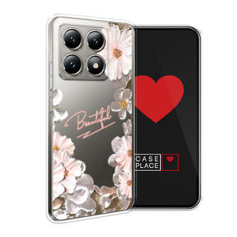 ����������� ����� ��������� ������� ������� �� Xiaomi 14T