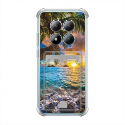  ������ 5 �� Redmi Note 15 Pro 4G