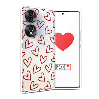 Силиконовый чехол Little hearts doodles 2 на Honor 70