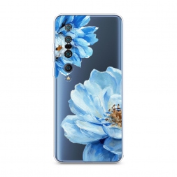����������� ����� ������� ��������� �� Xiaomi Mi 10 Pro