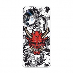 Soft touch ����� ����� � ������� �� Xiaomi 12T