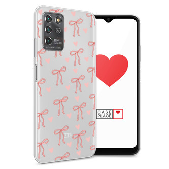 ����������� ����� ������� � �������� �� ZTE Blade V30 Vita