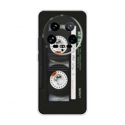 ����������� ����� ������� �� Xiaomi 14 Ultra