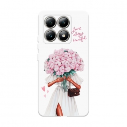 Soft touch ����� ������� � ������� ������ �� Xiaomi 14T