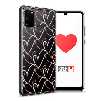 ����������� ����� ���� �� �������� �� Honor 9A