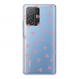 ����������� ����� ��������� ������� ������� �� Xiaomi Mi 11T