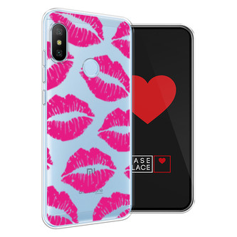 ����������� ����� ����-������� ������ ������� �� Xiaomi Redmi 6 Pro