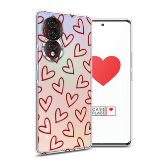 Силиконовый чехол Little hearts doodles 2 на Honor 80