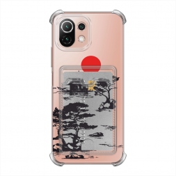  ���� ������ �� Xiaomi Mi 11 Lite