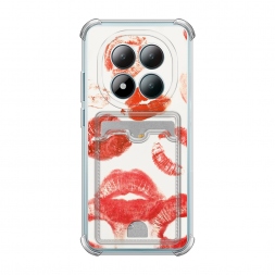 ������ ����� ������ �� Redmi Note 15 Pro 4G