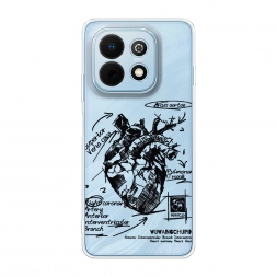 ����������� ����� ������������� ������ 2 �� Huawei Nova Y74
