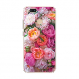����������� ����� ������ ����� �� Xiaomi Mi 5X