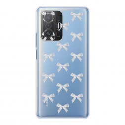 ����������� ����� ����� ������� �� Xiaomi Mi 11T