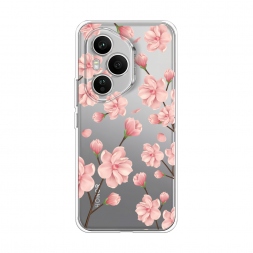 ����������� ����� �������� ������ �� Honor 400 Pro