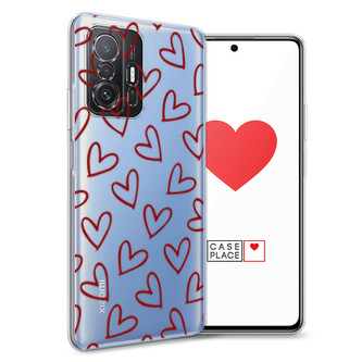 ����������� ����� Little hearts doodles 2 �� Xiaomi Mi 11T