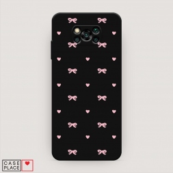 ������� ����������� ����� ������� ������� 3 �� Xiaomi Poco X3 Pro