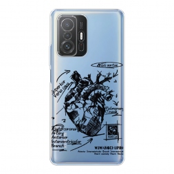 ����������� ����� ������������� ������ 2 �� Xiaomi Mi 11T