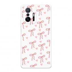 Soft touch ����� ������� � �������� �� Xiaomi Mi 11T