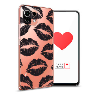 ����������� ����� ׸���� ������ ������� �� Xiaomi Mi 11 Lite