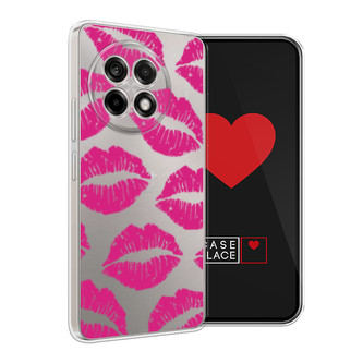 ����������� ����� ����-������� ������ ������� �� Oneplus Ace 5