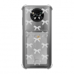 ������ ����� ������� �� Xiaomi Poco X3 NFC
