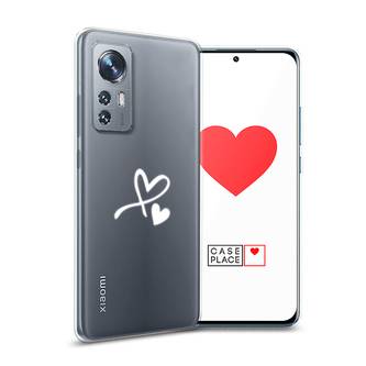 ����������� ����� �������� ���������� �� Xiaomi 12X