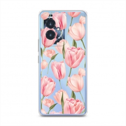 ����������� ����� �������� �������� �� Honor 100