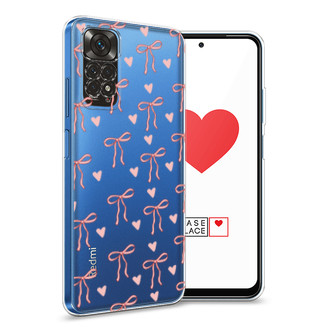 ����������� ����� ������� � �������� �� Xiaomi Redmi Note 11S