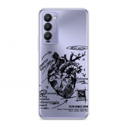Силиконовый чехол Анатомическое сердце 2 на Tecno Camon 18