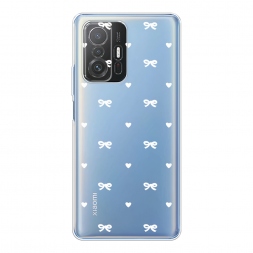 ����������� ����� ������� ������� 1 �� Xiaomi Mi 11T