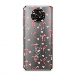 ����������� ����� ������� � �������� �� Xiaomi Poco X3 Pro