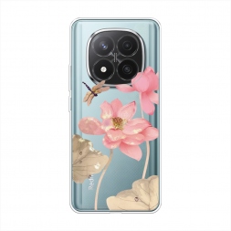 ����������� ����� ������� ������ �� Xiaomi Redmi Note 14 Pro Plus 5G